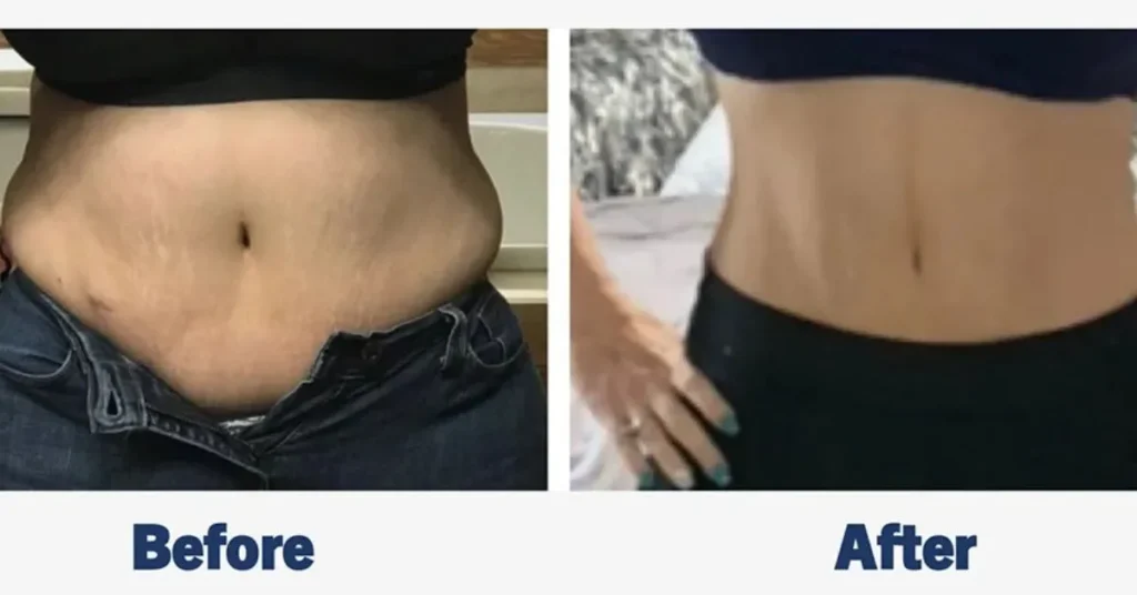 Does Red Light Therapy Actually Help With Weight Loss